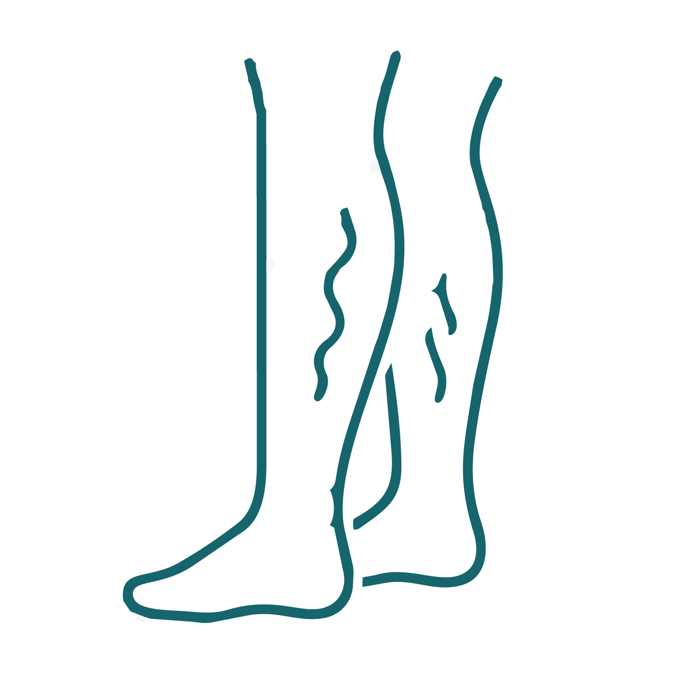 Treat Varicose